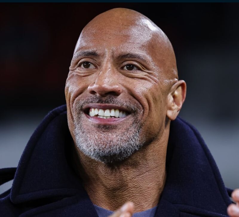 nalyso3 e1742910782962, 4, Стрижки для мужчин с разными типами и стадиями облысения: названия, фото стрижки для лысых